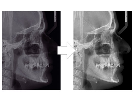 Kwaliteit radiografieën